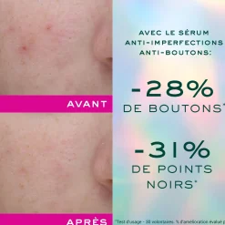 Zinc [pca]|Teint Unifié & Pores Resserreés|NUXE Sérum anti-imperfections anti-boutons